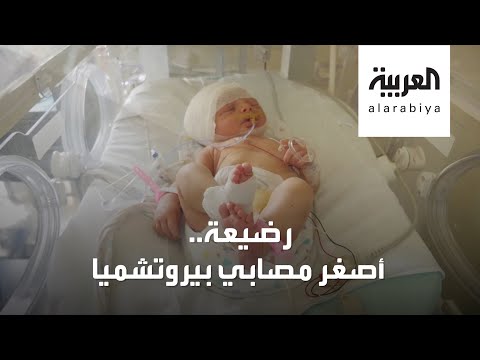 شاهد قصة أصغر مصابة بتفجيرات بيروت خطفت قلوب الجميع