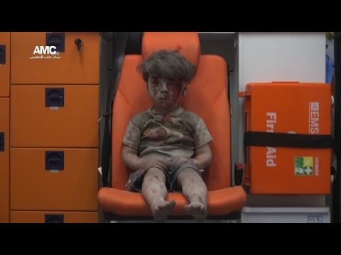 little boy in aleppo a vivid reminder of wars horror