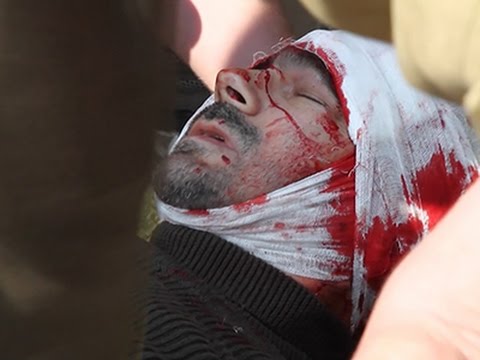 russian journalist hurt in eastern ukraine